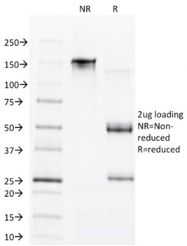 CDX1 Antibody
