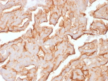 MUC16 Antibody