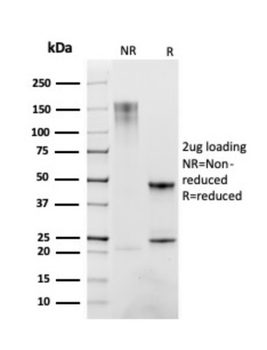 CD163 Antibody