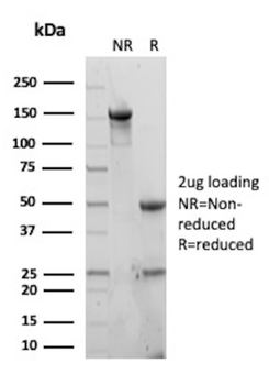 CD81 Antibody