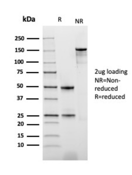 TYMP Antibody