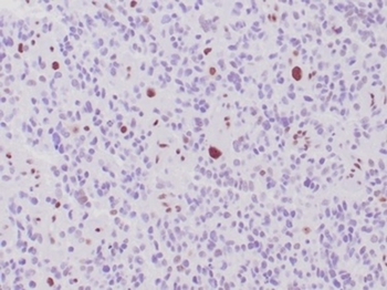 ATRX Antibody
