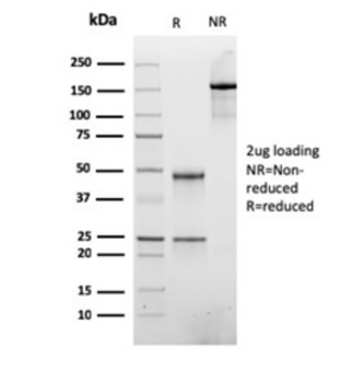 ATRX Antibody