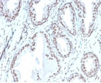 ATRX Antibody