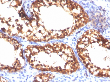 VCL Antibody