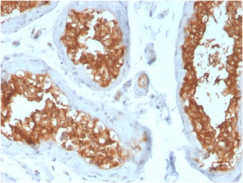 VCL Antibody