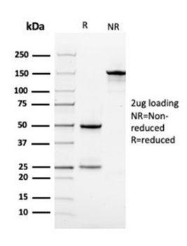 VCL Antibody