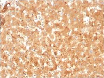 A2M Antibody