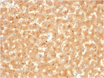 A2M Antibody