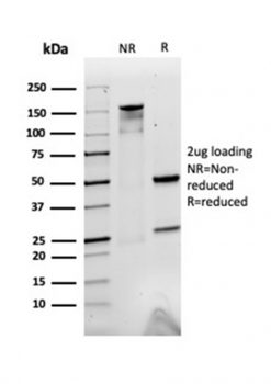 A2M Antibody