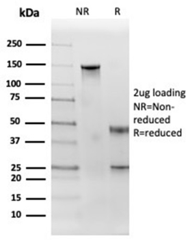 TFRC Antibody
