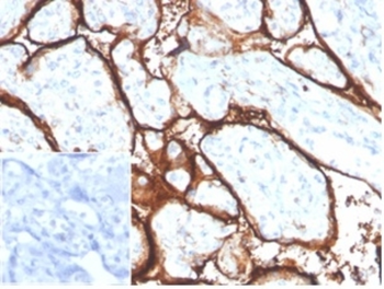 TFRC Antibody