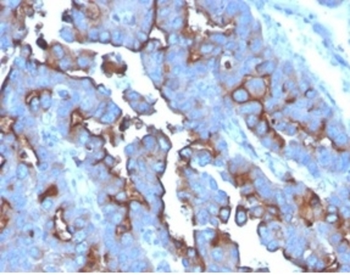TFRC Antibody