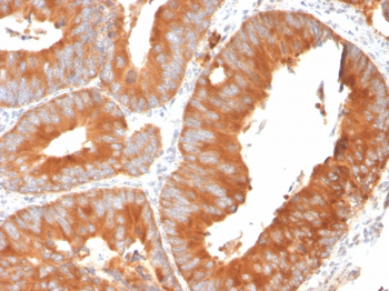 SLAMF7 Antibody