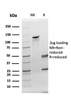 TPO Antibody
