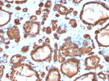 TPO Antibody