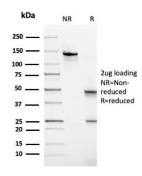 TPO Antibody