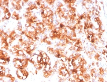 FOLH1 Antibody