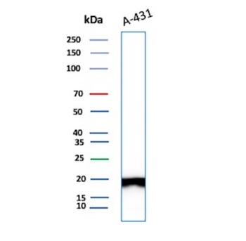 FTL Antibody