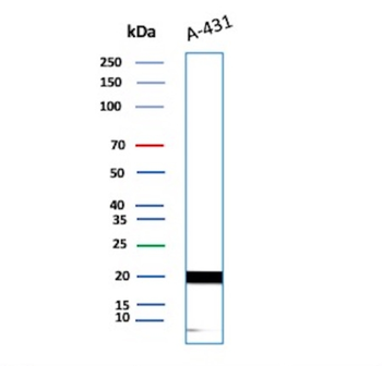 FTL Antibody