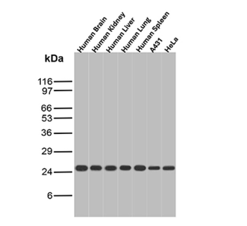 FTL Antibody