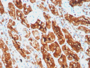 FTL Antibody