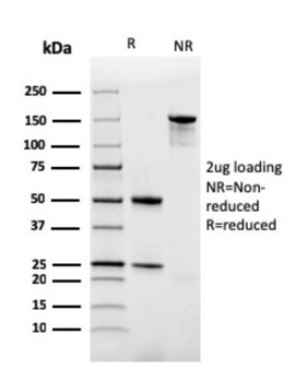 FTL Antibody