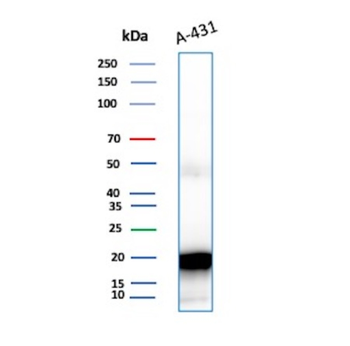 FTL Antibody