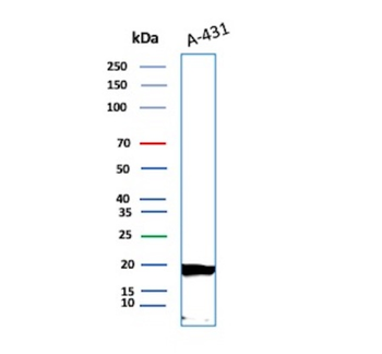 FTL Antibody
