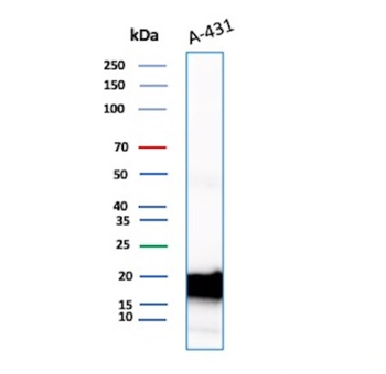 FTL Antibody