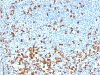 ZAP70 Antibody