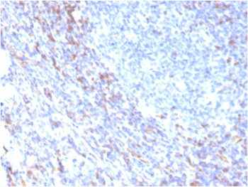 ZAP70 Antibody