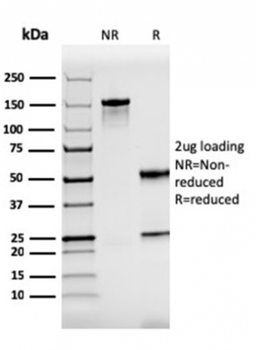 ZAP70 Antibody