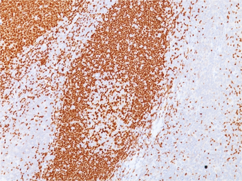 PAX5 / BSAP (Early B-Cell Marker) Antibody