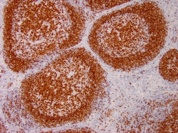 PAX5 / BSAP (Early B-Cell Marker) Antibody