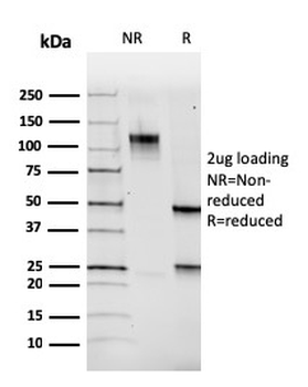 PAX5 / BSAP (Early B-Cell Marker) Antibody