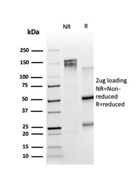 TRIM27 Antibody