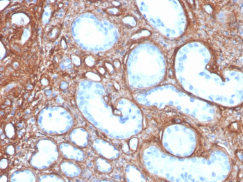 COL4A1 Antibody