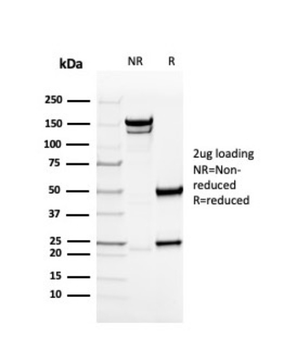 COL4A1 Antibody