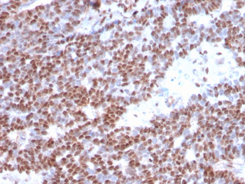 Estrogen Receptor, alpha (Marker of Estrogen Dependence) Antibody