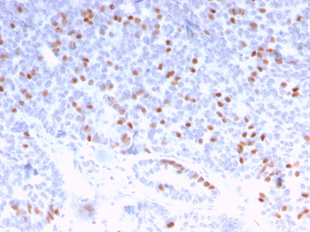 ESR1 Antibody (Biotin)