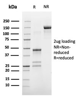 Estrogen Receptor, alpha (Marker of Estrogen Dependence) Antibody