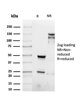 IFNG Antibody