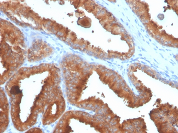 KLK3 Antibody