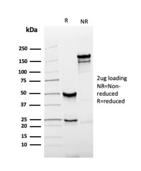 KLK3 Antibody