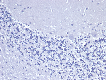KRT8 Antibody