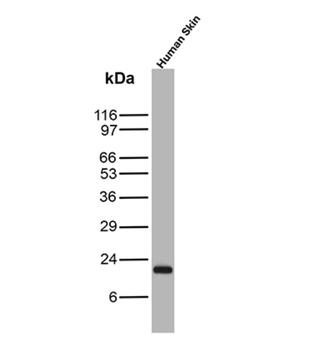 SCGB2A2 Antibody