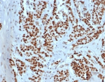 MSH2 Antibody