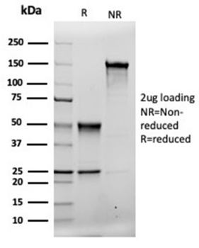 MSH2 Antibody