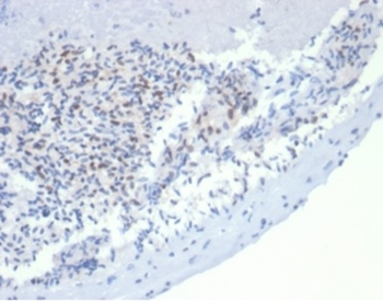 MSH2 Antibody